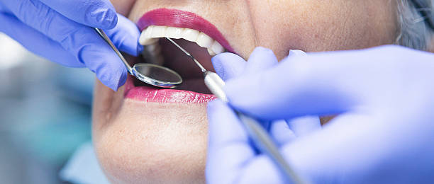Best Emergency Dental Extractions in Lakewood Park, FL